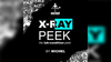 X-Ray Peek by Michel